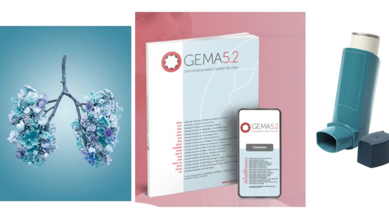 ACTUALIZACIÓN 5.2 DE LA GUÍA GEMA